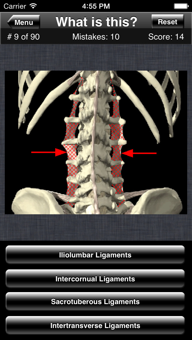 Anatomy Spine Quiz screenshot1