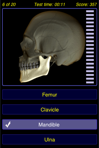 Musculoskeletal System - Anatomy Quiz (Free) free app screenshot 4