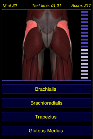 Musculoskeletal System - Anatomy Quiz (Free) free app screenshot 2