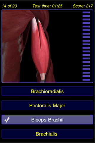 Musculoskeletal System - Anatomy Quiz (Free) free app screenshot 3