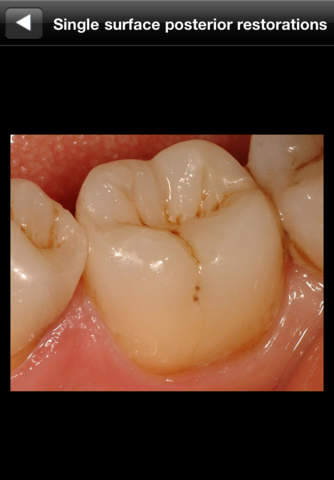 【免費醫療App】Dental Composite-APP點子