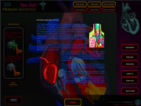 Open Heart 3d screenshot 2