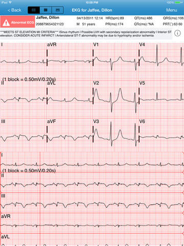 【免費健康App】Vocera Cardiac Consult HD-APP點子