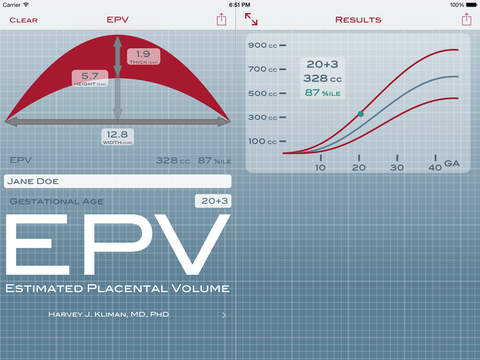 【免費醫療App】EPV Calculator-APP點子