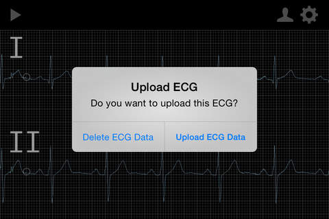 Spaulding ECG screenshot 2