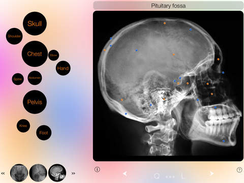 【免費醫療App】Xray Anatomy-APP點子