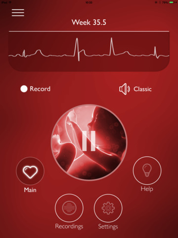 【免費醫療App】My Baby's Beat - Hear baby heartbeat sound-APP點子