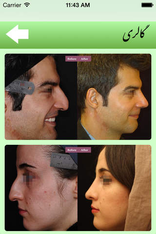 Beauty Nose Surgery screenshot 2