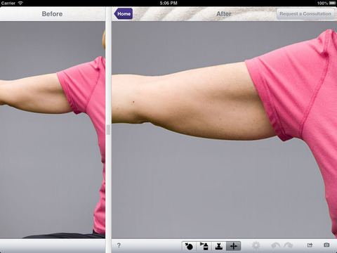 Imagine Plastic Surgery for iPad screenshot 2