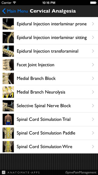 【免費醫療App】iSpinePainManagement-APP點子