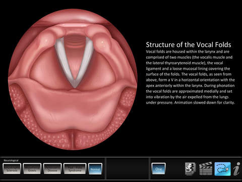 Vocal Pathology: Neurological