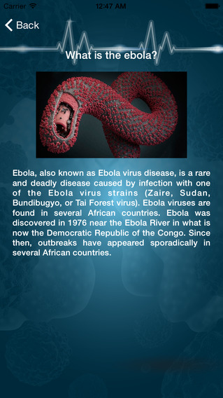 Ebola Risks