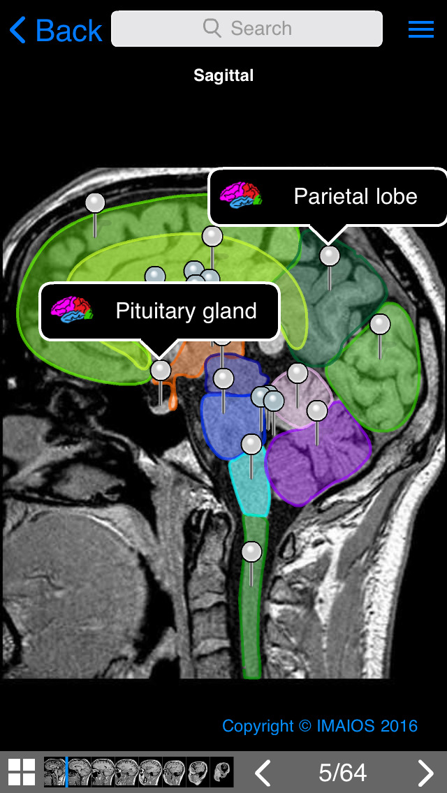 imaios e anatomy ipa crack