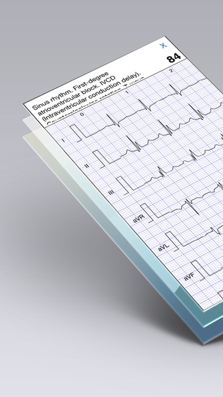 【免費醫療App】ECG Books Pro - Abnormal ECG (EKG) Case Database from AHA-APP點子