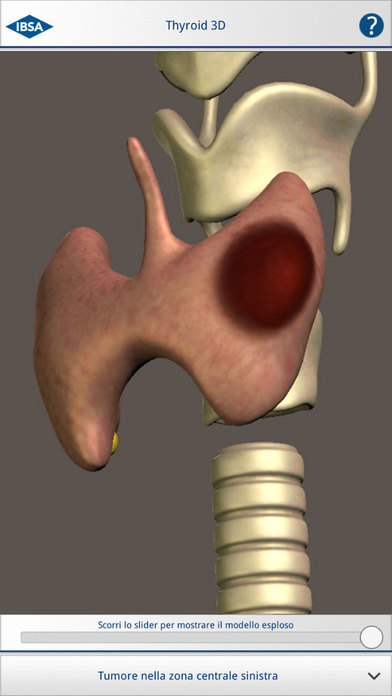 Thyroid 3D screenshot 2