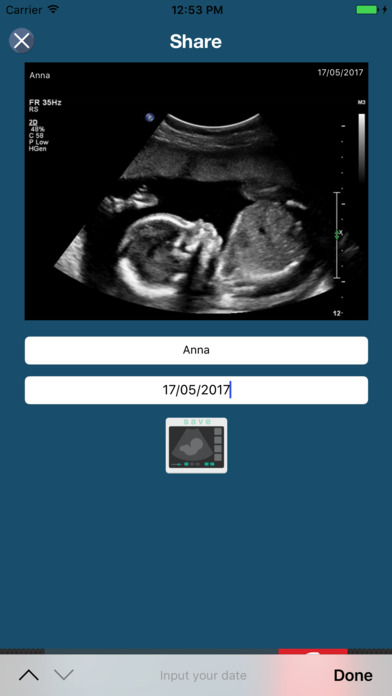 Ultrasound Prank - Fake Pregnancy Trick screenshot 2