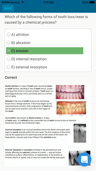 Crack iNBDE Dental Boards Prep screenshot 4