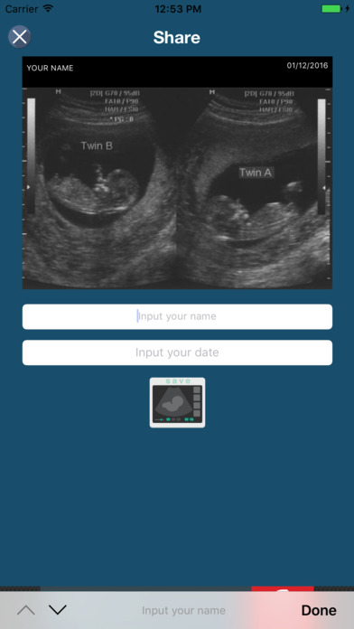 Baby Ultrasound - Prank Ultrasound Spoof screenshot 3