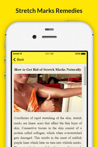 How To Get Rid Of Stretch Marks - Get Rid of Stretch Marks after Pregnancy screenshot 2