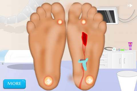 Foot Surgery ™ screenshot 2
