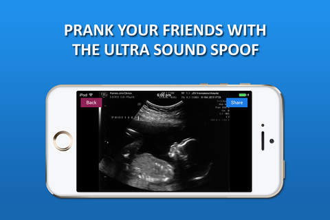 New Ultrasound Spoof Prank screenshot 2