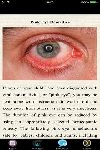 Pink Eye Remedies - Natural Treatment screenshot 3