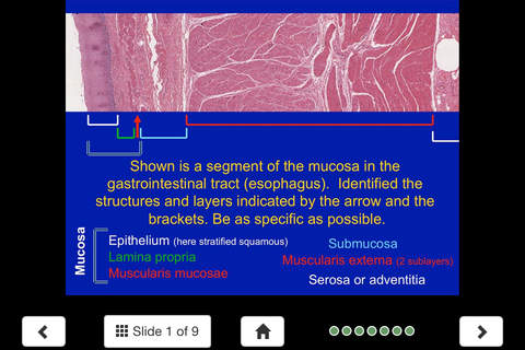 Histology – Gastrointestinal Tract screenshot 3