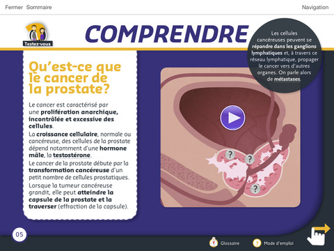 Traitements hormonaux du cancer de la prostate – e-Guide Visuel du Patient screenshot 3