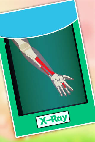 Arm Surgery - Doctor care and hand surgeon game screenshot 4