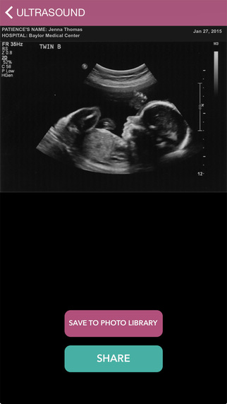 【免費攝影App】My Ultrasound: Prank App-APP點子