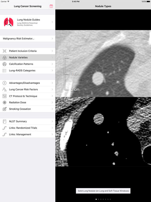 download lung cancer diagnosis download lung cancer diagnosis