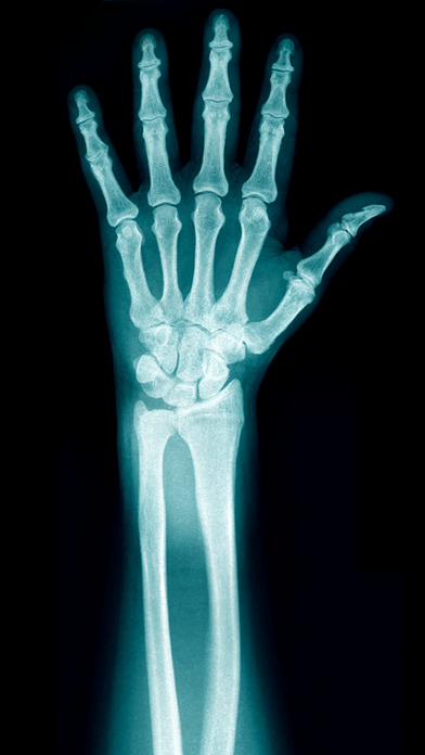 Best X-Ray FREE App Download - Android APK