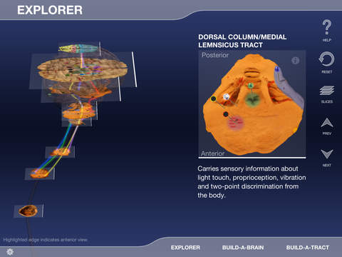 Build-A-Brain Explorer - náhled